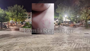 Λαμία: Σκύλος όρμησε και δάγκωσε 5χρονο αγοράκι σε...καφετέρια