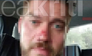 Σοβαρή καταγγελία ξεναγού: Με ξυλοκόπησε σεκιούριτι γιατί πήγα για μπάνιο κοντά σε οργανωμένη παραλία