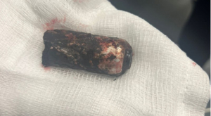 Η ναυτική φωτοβολίδα που τραυμάτισε τον αστυνομικό στα επεισόδια με τους χούλιγκαν στου Ρέντη