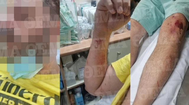 Ρομά ξυλοκόπησαν άγρια 40χρονο επειδή τους έκανε παρατήρηση για τη μουσική