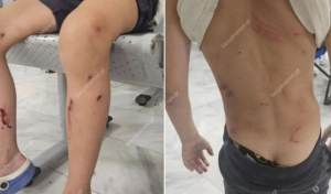 Βόλος: Από θαύμα γλίτωσε 7χρονος όταν του επιτέθηκαν αδέσποτα σκυλιά - Παραλίγο να το κατασπαράξουν, λέει η μητέρα του