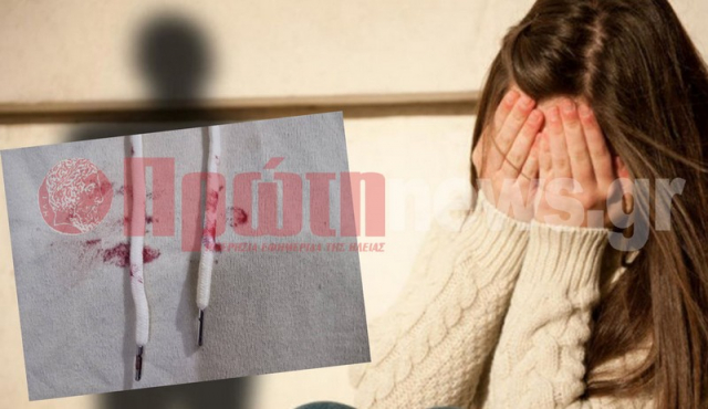Δυτική Ελλάδα: Πατέρας έστειλε την 13χρονη κόρη του στο Νοσοκομείο μετά από χτύπημα!