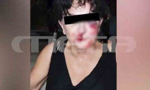 Μπράβοι της έκοψαν τη φωνητική χορδή από το ξύλο: Είχε κάνει παρατήρηση... για τη δυνατή μουσική σε club