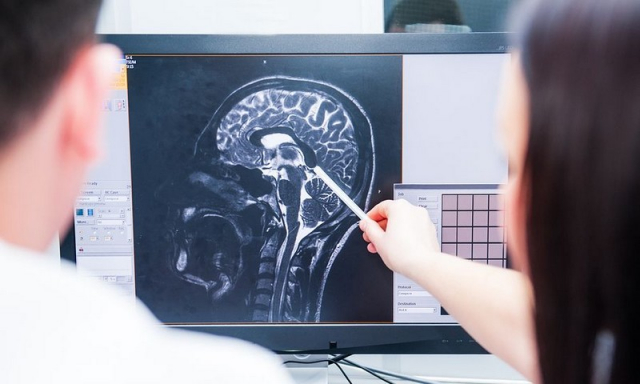 Καρκίνος του εγκεφάλου: Νέο φάρμακο θα μπορούσε να «θεραπεύσει» την πιο επιθετική μορφή του