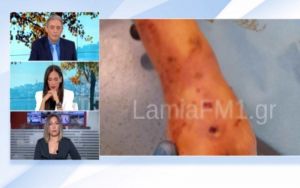 Λαμία: Άγρια επίθεση σκύλου σε 35χρονη