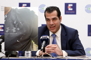 Θάνος Πλεύρης: Το ιατρικό ανακοινωθέν μετά την επίθεση με γιαούρτια